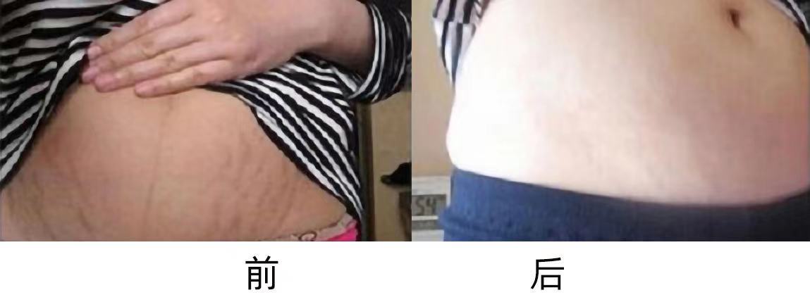 唇线笔的使用方法和技巧